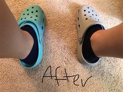 Use Boiling Water To Unshrink Your Crocs